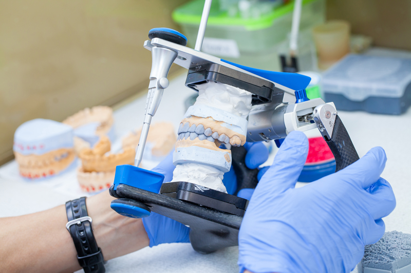 dentist implantologist showing dental implant technology on tooth jaw model to patient visit in clinic office.