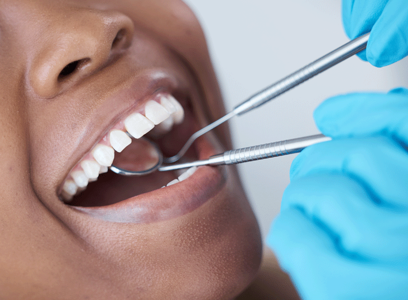 Close-up of a dentist checking a patient's teeth during a checkup.