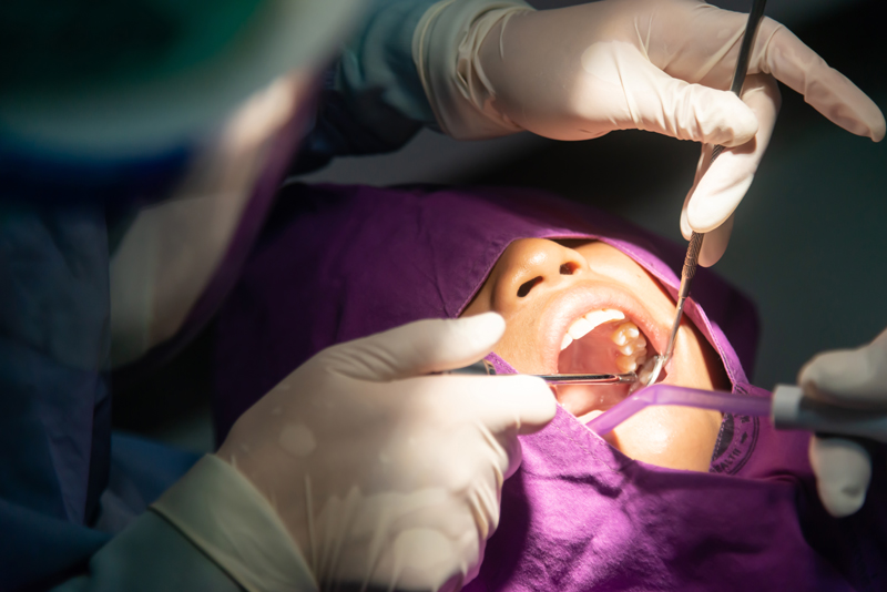 Tooth removal . Dental, dentists, dental laboratories in low light conditions. Oral health and teeth.